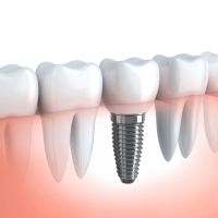 SF Dental ico