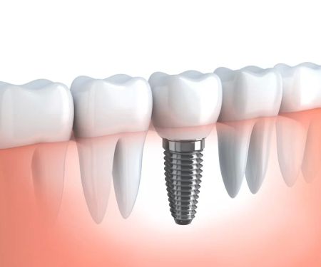 SF Dental