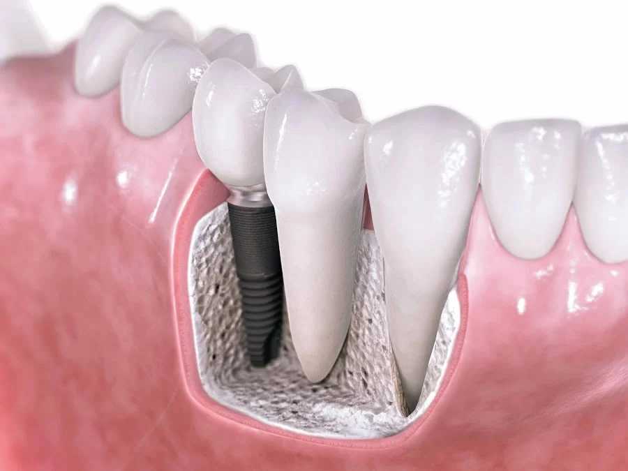 SF Dental Picture 9