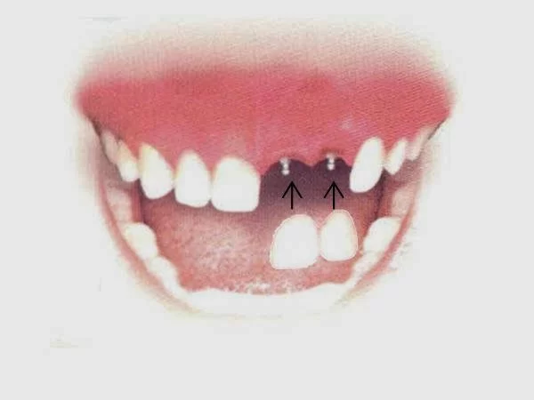 Dr. Attalla DDS Picture 2