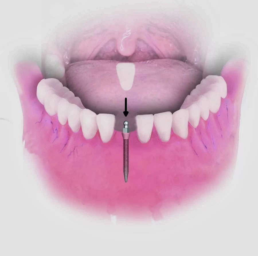 Dr. Attalla DDS Picture 3