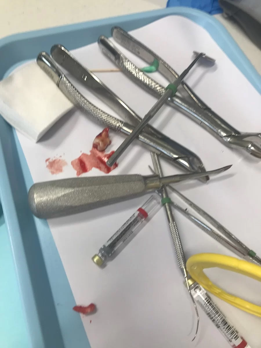 Urgent Dental | Cosmetic & Family Emergency Dental Las Vegas Picture 9