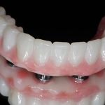 Innovative Dental of Springfield