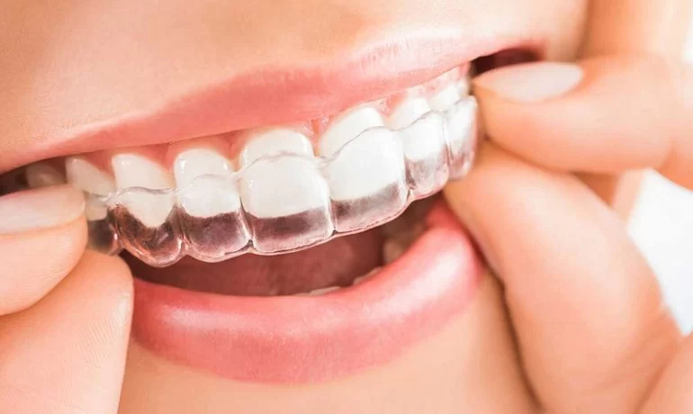 Belmont Orthodontics Picture 1