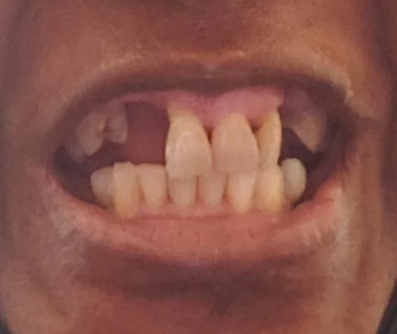 Cicero Dental Center Picture 1