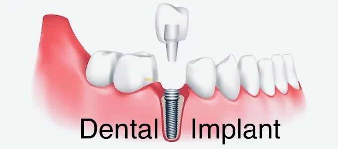 Cambridge Port Dental Picture 2