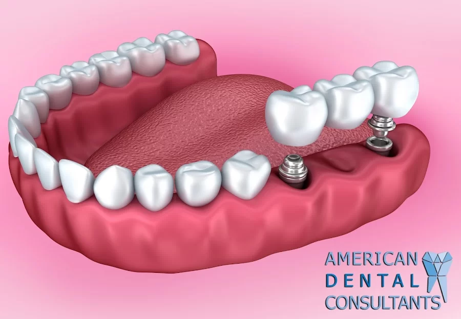 American Dental Picture 7