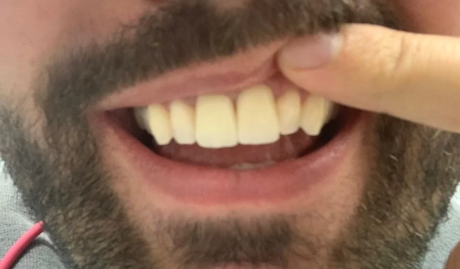 Alpha Dental Somerville Picture 1