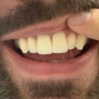 Alpha Dental Somerville ico