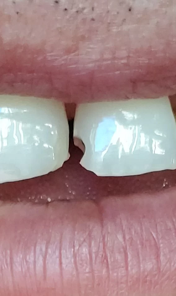 Global Dental Picture 4