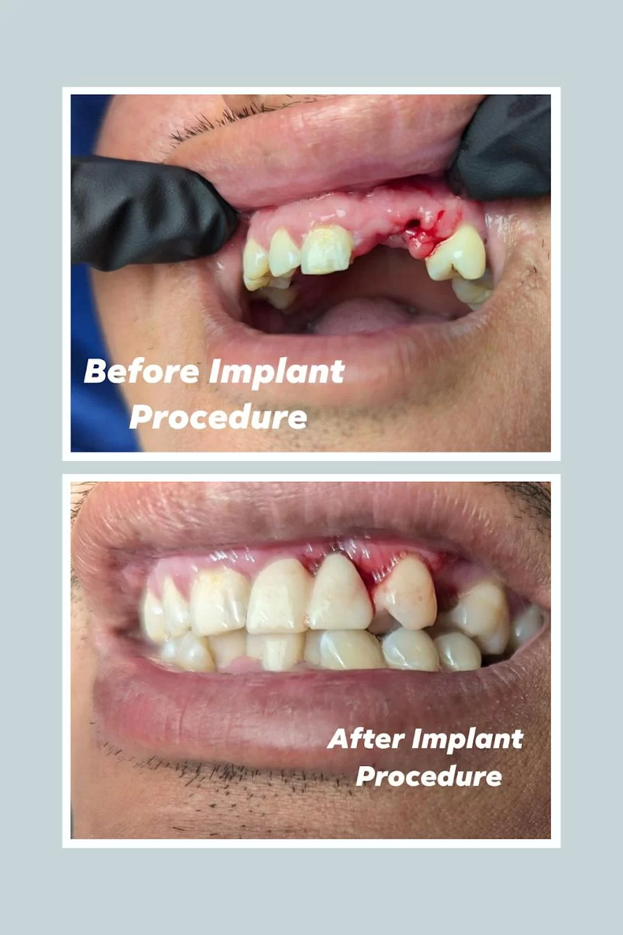 Jace Dental Picture 9