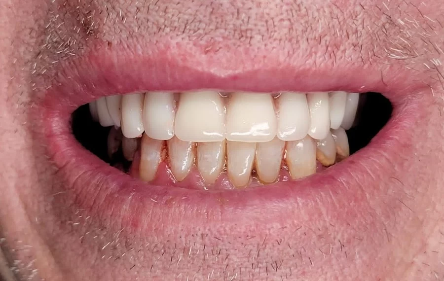 Central Dental Associates Picture 1
