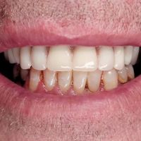 Central Dental Associates ico