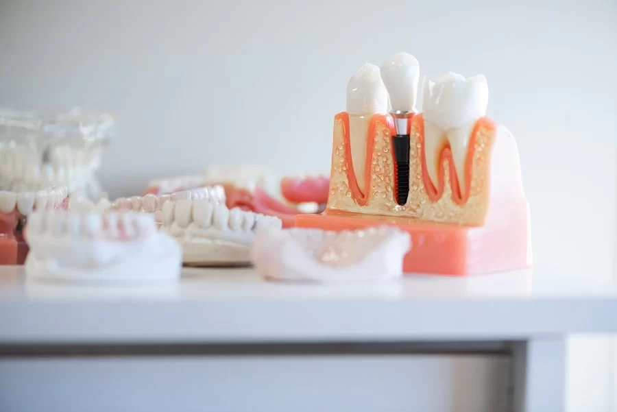 PerioImplant Associates - New Albany, IN Picture 1