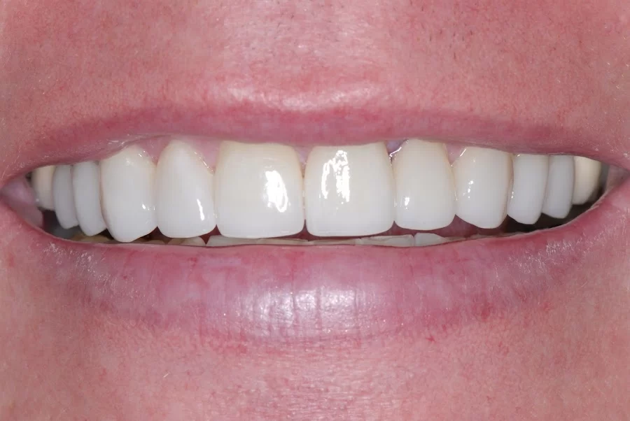 Lakeview Dental Care in Chandler Picture 1