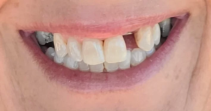 Chandler Implants & Periodontics Picture 3
