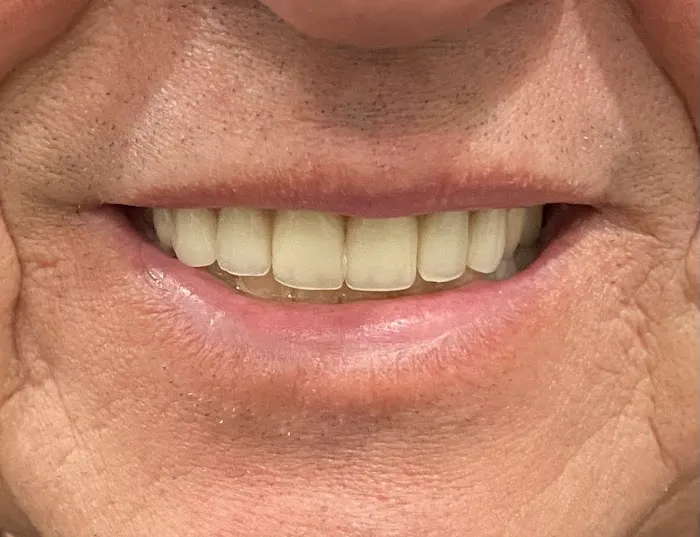 Hi-Dent Dental Laboratory Picture 1