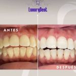 Consultorio Dental Luxurydent (Dentista en Matamoros)