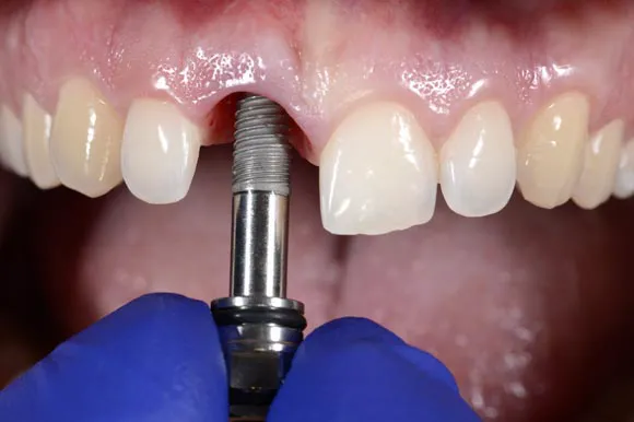 Clínica Dental Funnydent ( Dentistas en Matamoros ) Picture 3