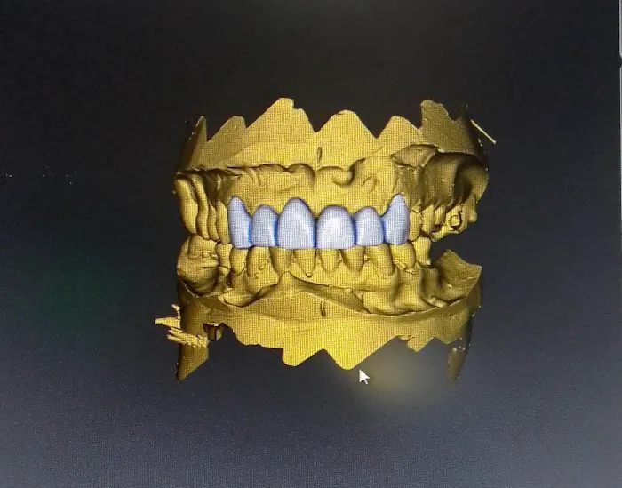 EVO-DENT Picture 2