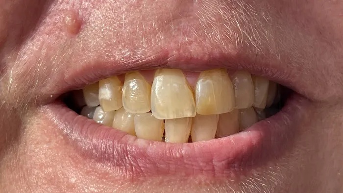 van Hofwegen Dental Picture 4