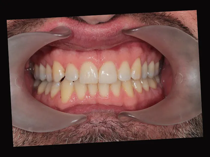 Van Dental Clinic Picture 6