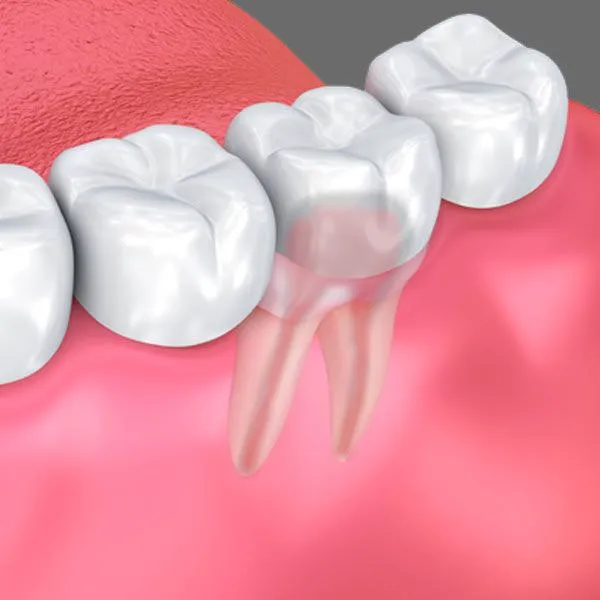 Golden Triangle Periodontal Center Picture 7