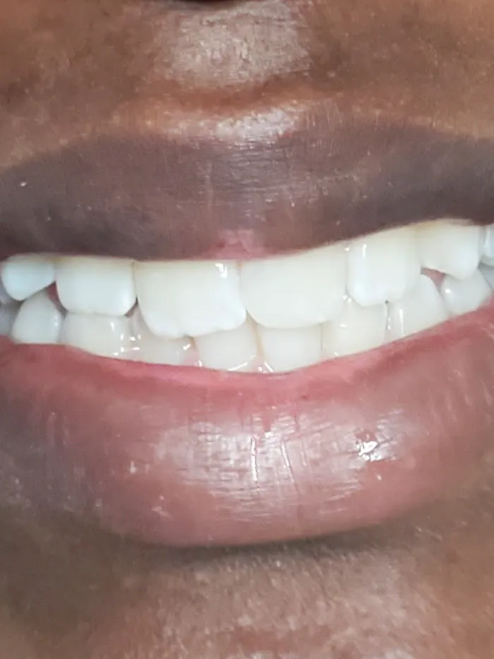Shine Dental Adults&Kids Picture 7