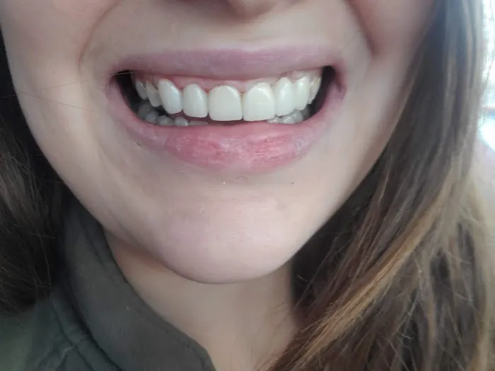 Affordable Dental Care Picture 2