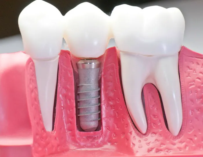 Grand Dental, P.C. Picture 5