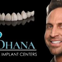 Ohana Dental Implant Centers ico