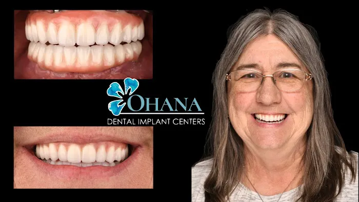 Ohana Dental Implant Centers Picture 2