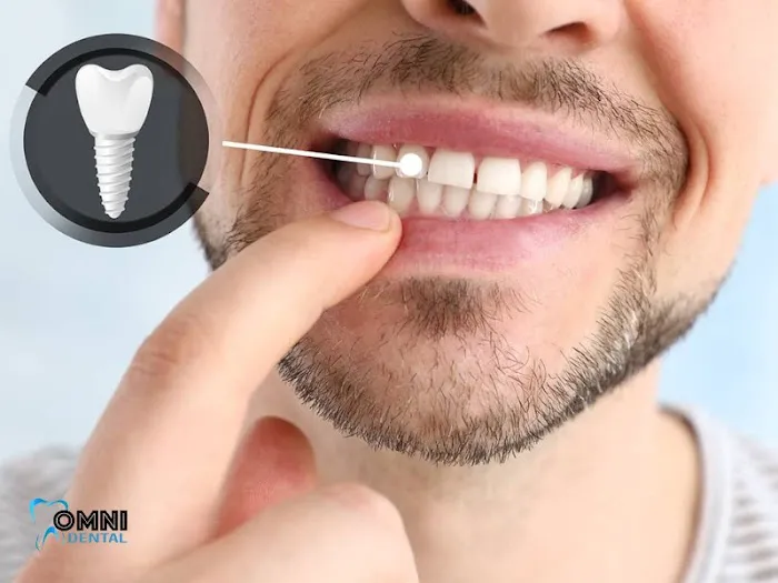 Omni Dental of Arlington Heights Picture 5