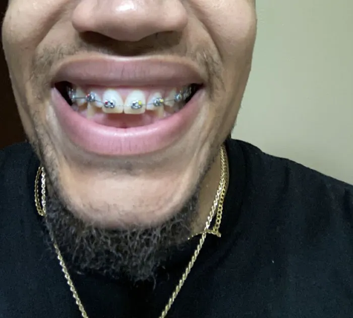 Home of the Perfect Smile Picture 4