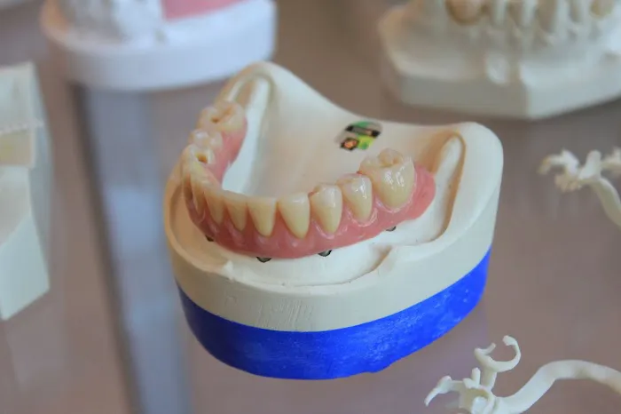 University Dental Associates- Dr. Ronald W. Orr Picture 5