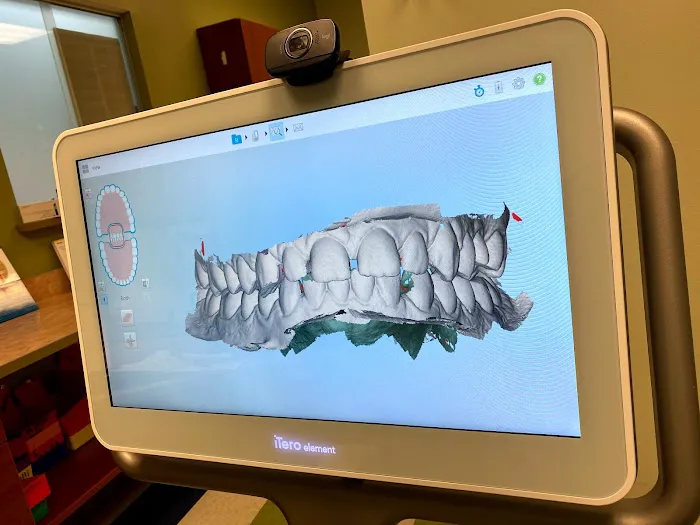 Aspen Dental - Strongsville, OH Picture 6