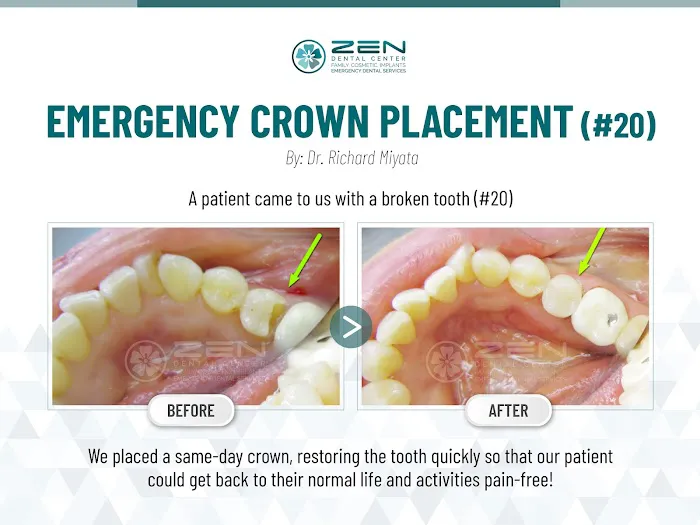Zen Dental Center Family Cosmetic Emergency Implants Picture 2