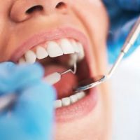 California Dental Group ico