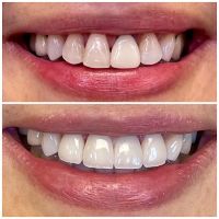 Glen Dental Studio: Stepan Harutyunyan, DMD ico
