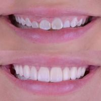 South Gate Dental Clinic ico