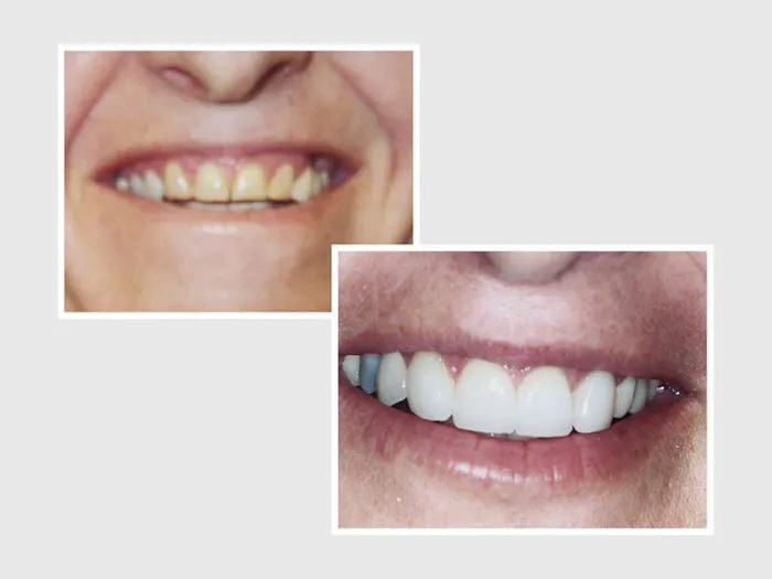 Dr. Nader Nikman D.D.S - Brentwood Center for Cosmetic Dentistry Picture 3