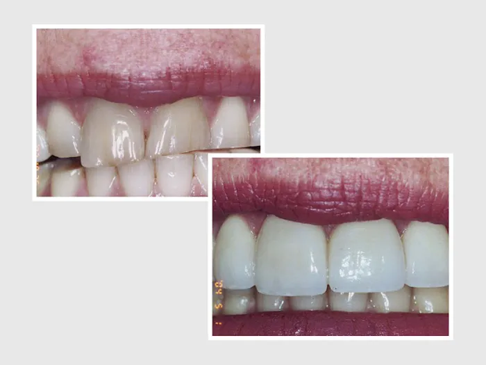 Dr. Nader Nikman D.D.S - Brentwood Center for Cosmetic Dentistry Picture 1