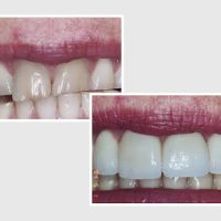 Dr. Nader Nikman D.D.S - Brentwood Center for Cosmetic Dentistry ico