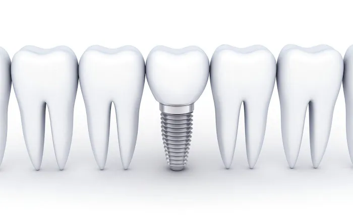 St. Mary Dental - Saeda Basta, DDS, MS Picture 4