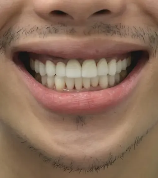 Urgent Dental Center & Family Dentistry Picture 4