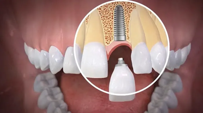 Singley & Crane Family Dentistry Picture 1
