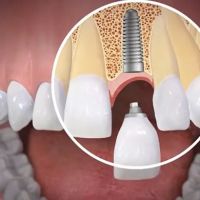 Singley & Crane Family Dentistry ico