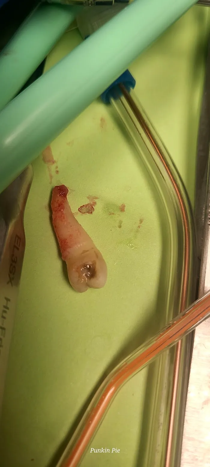 Urgent Dental Center & Family Dentistry Picture 7