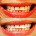 Redwood Dental Centre