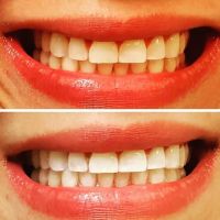 Redwood Dental Centre ico
